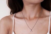 Признаки увеличенной щитовидной железы и как их распознать