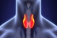 Як УЗД допомагає відстежувати рецидив раку щитоподібної залози?