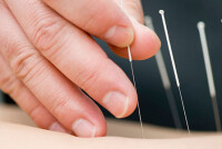 Акупунктура при высоком давлении: противопоказания и особенности процедуры
