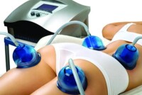 Эффективная коррекция фигуры: преимущества технологии Starvac