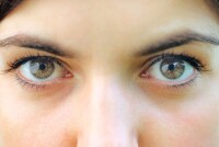 Помутнение хрусталика — катаракта