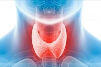 Признаки йододефицита: как распознать проблему по внешним симптомам