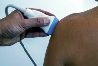 Инновационная замена плечевого сустава в Израиле: Опыт лучшей частной клиники Ассута