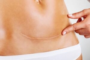 Новое тело: Путеводитель по пластике после родов и радикального похудения