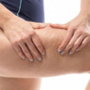 Продукты для здоровья: как питание влияет на борьбу с целлюлитом