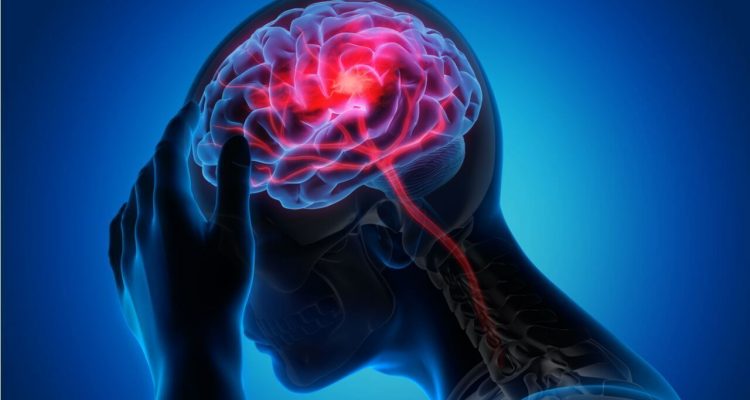 Признаки надвигающегося инсульта: на что обратить внимание при повышенном давлении