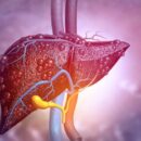 Признаки на лице, указывающие на проблемы с печенью: что нужно знать