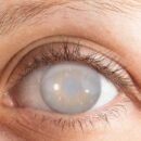 7 ранних признаков проблем со зрением: как сохранить здоровье глаз