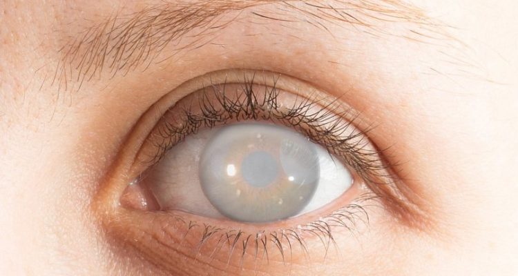 7 ранних признаков проблем со зрением: как сохранить здоровье глаз