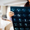 Давление и рак: 10 ранних признаков, которые нельзя игнорировать