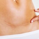 Новое тело: Путеводитель по пластике после родов и радикального похудения